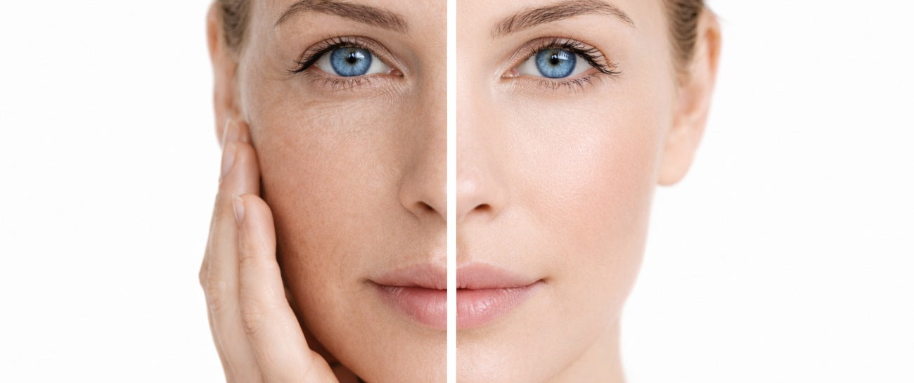 What Causes Dull Skin and How to Restore Radiance Gently